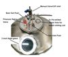 Picture of New 65L Stainless Steel Conical Fermenter Basic Setup